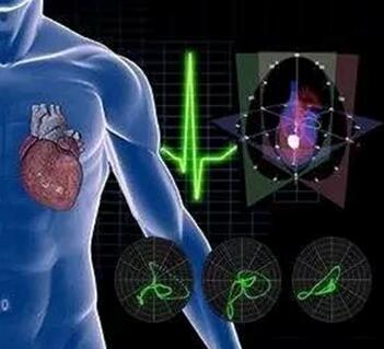 άĵϲƷ4D-ECG