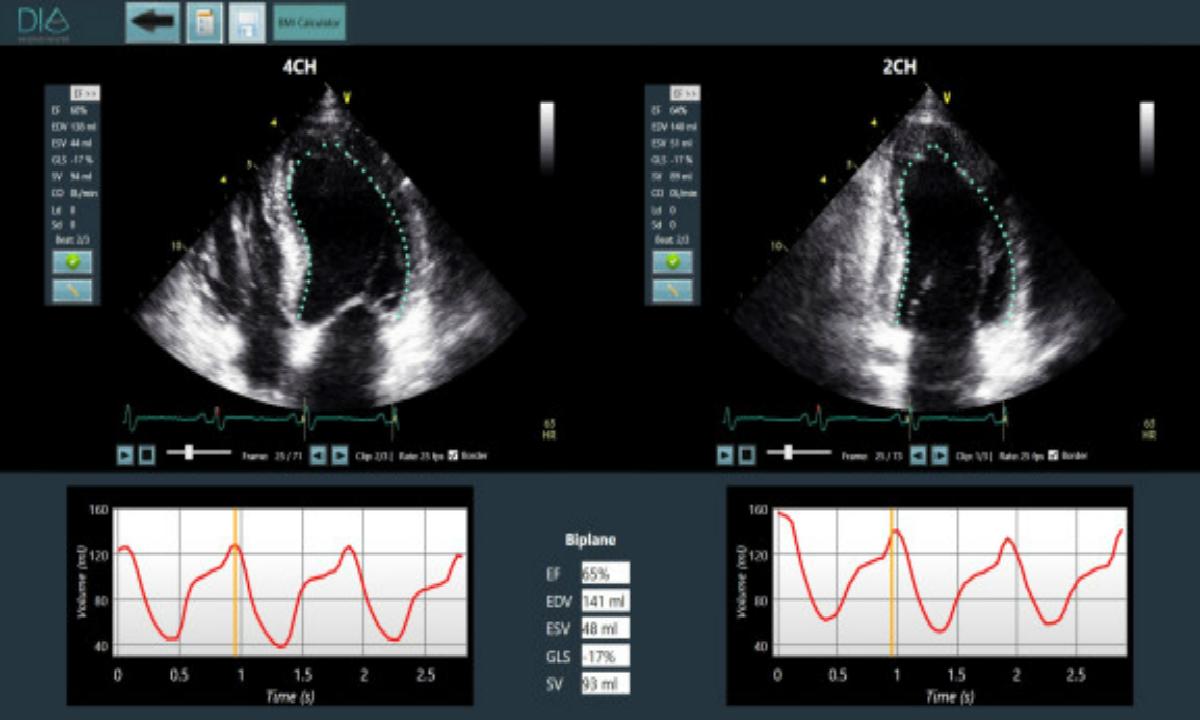 Dia Imaging AnalysisAʣAIܳɨ輼