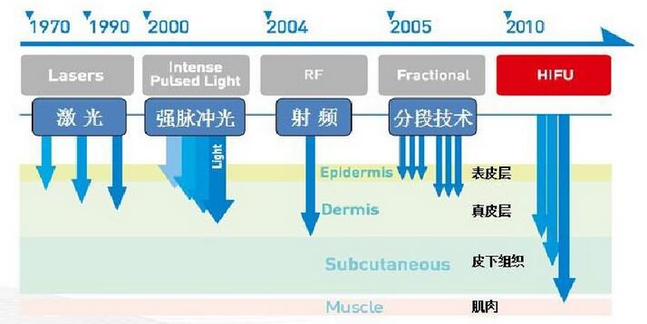 ǿȾ۽High-Intensity Focused UltrasoundHIFU