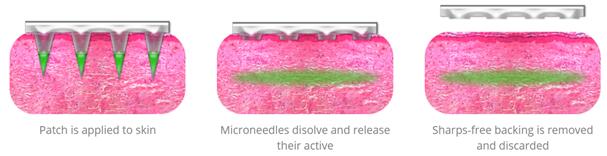 Micron Biomedical׸Զͯ΢ٴ