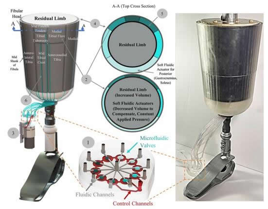用于下肢截肢者的微流控柔性机器人假肢原型的概念验证图（左）和原型照片（右）