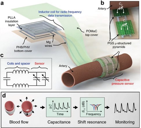 可生物降解的柔性动脉脉搏传感器，用于无线监测血流