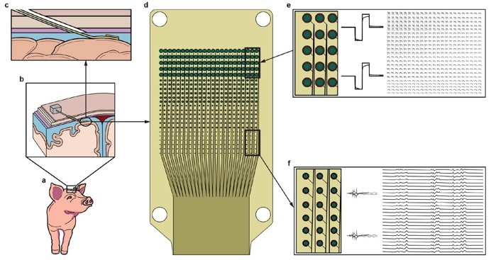 ԻӿڳPrecisionFDAͻҽе϶չһMEMS