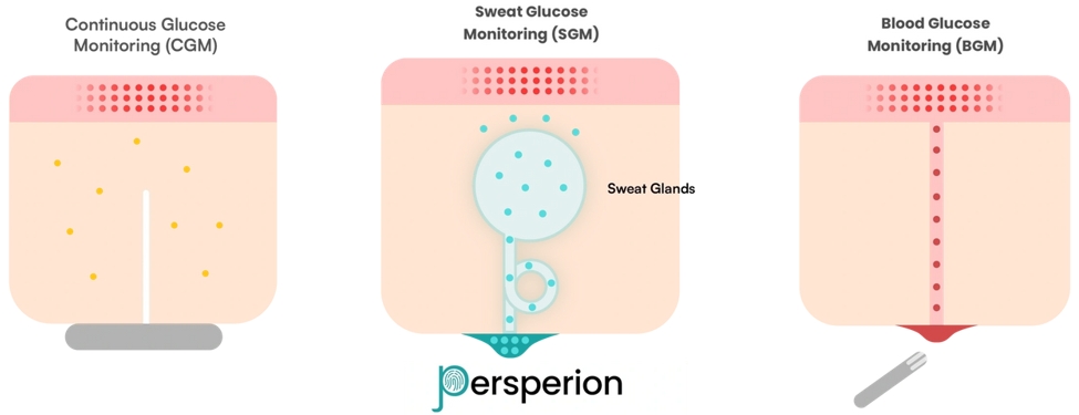 ѪǼ⣨ͼPersperion DiagnosticsҺѪǼ⣨ͼͳָѪѪǼ⣨ͼ