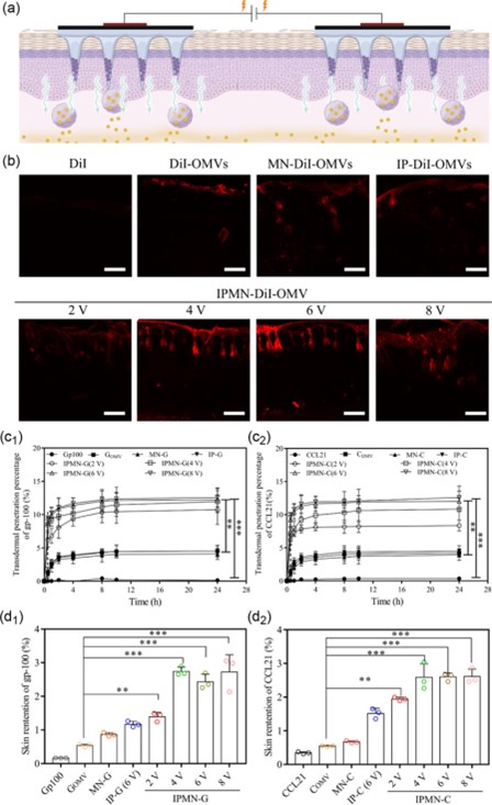  IPMN-GIPMN-C⾭Ƥgp100CCL21׵о
