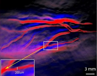 该光声成像技术可以在200微米（人体头发的直径）水平上区分人体动脉（红色）和静脉（蓝色）。同样的增强检测可用于癌细胞的识别