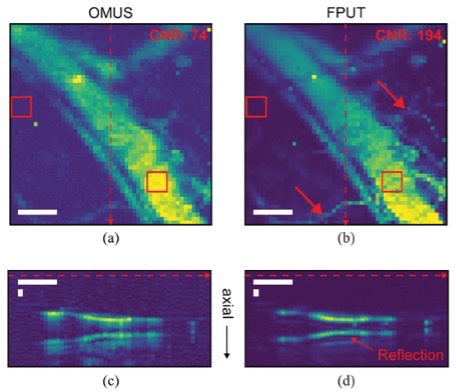 分别使用OMUS和25 MHz FPUT记录的小鼠耳部血管系统的离体显微图像