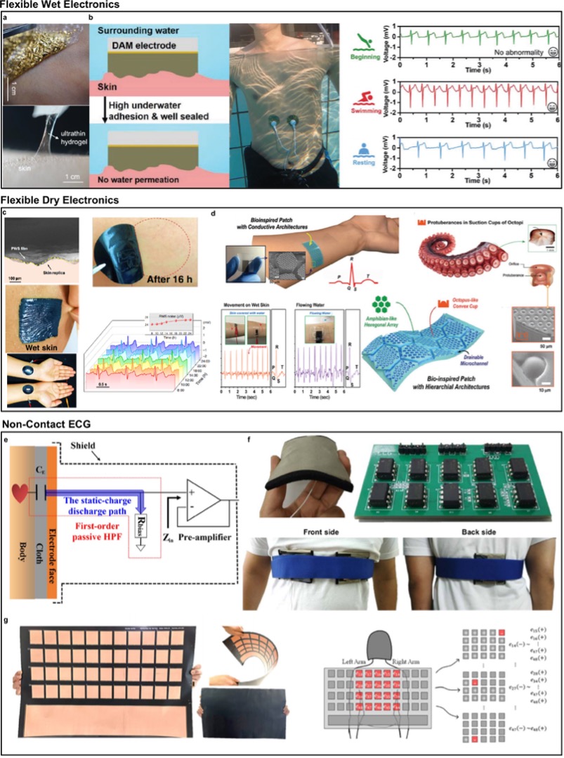 可穿戴心电图传感器