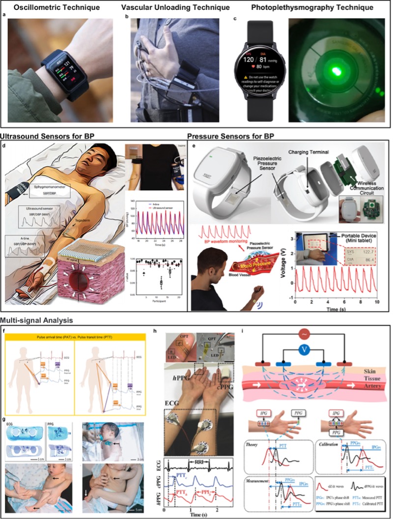 可穿戴血压传感器