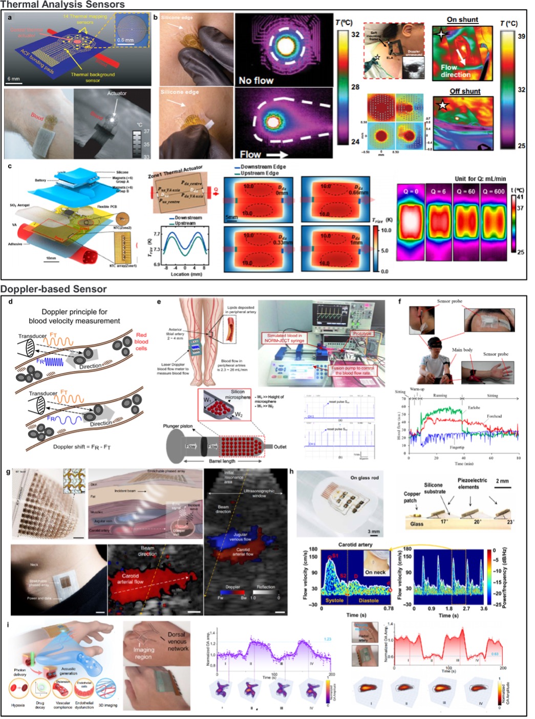 可穿戴血流传感器