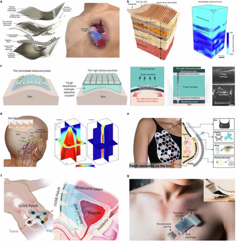 可穿戴超声成像传感器