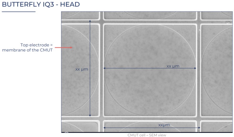 Butterfly Network公司开发的CMUT单元的扫描电镜图