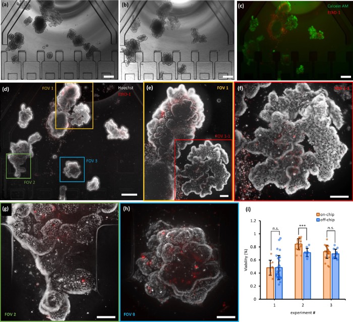 对在OrganoidChip+中培养的荧光标记类器官进行宽场成像