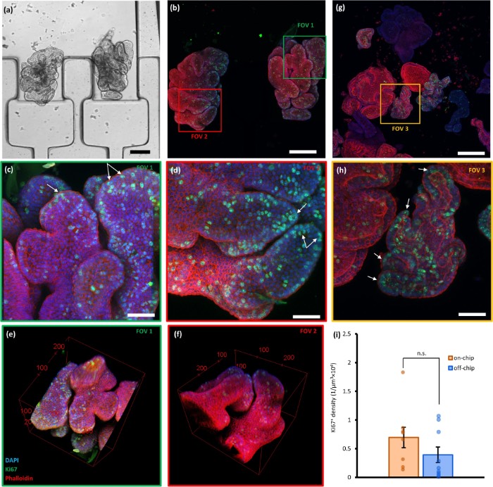 类器官在芯片外与芯片上培养、生长及免疫荧光染色后获取的荧光共聚焦图像