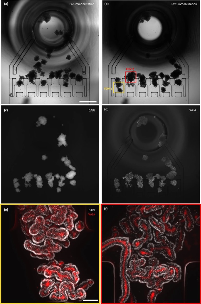 在同一芯片内培养、固定并经DAPI和WGA染色的类器官高分辨率图像