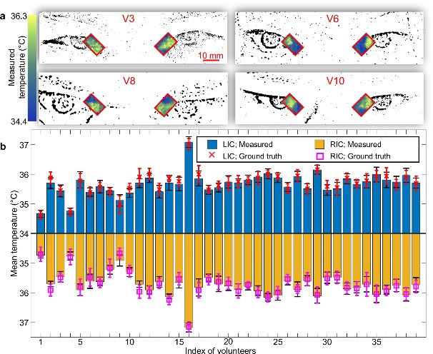 利用单像素红外成像测温仪绘制的人体内眼角的温度图
