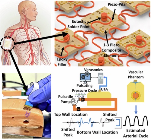����PMN-PT�����Գ������������У����������Ѫѹ���