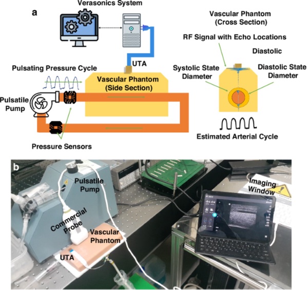 Ѫѹ���ʵ��