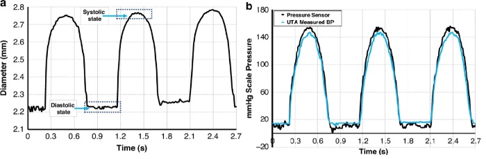 Ѫ�ܶ���ֱ������ʵ��