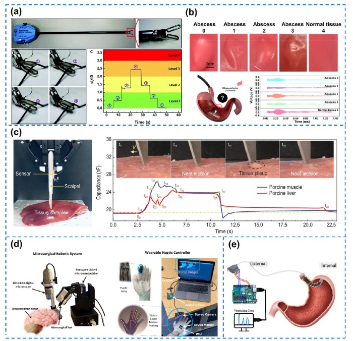 用于智能医疗应用的先进触觉传感技术