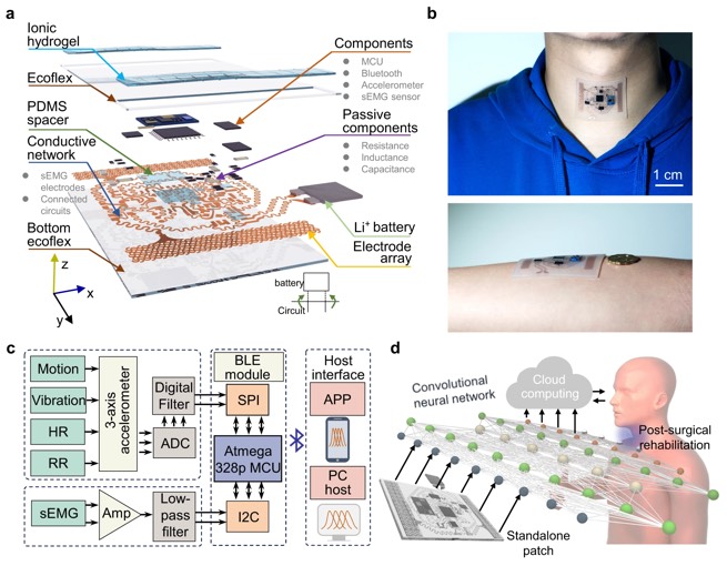 可拉伸传感器——咽喉贴片概览