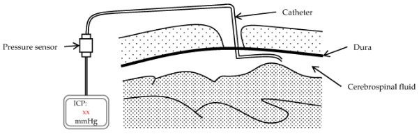 ­��ѹ��������ԭ��ͼ